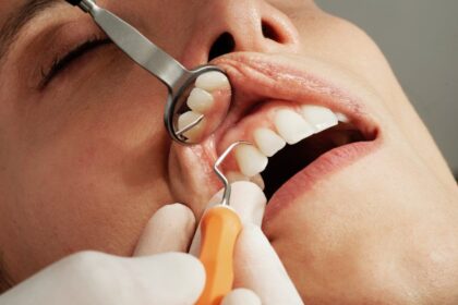 Early Detection and Treatment of Gum Disease