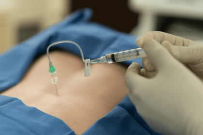 Epidural Steroid Injections