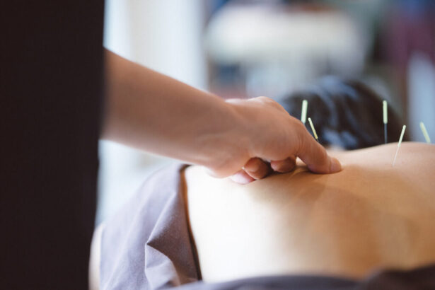 Acupuncture in Traditional Medicine