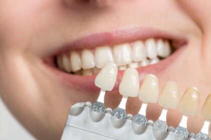 Porcelain Veneers