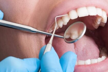 Role of Periodontal Treatments for Gum Health