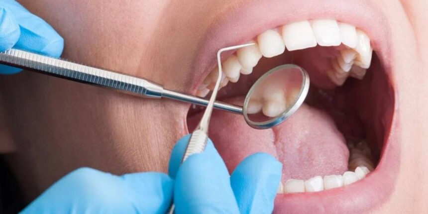 Role of Periodontal Treatments for Gum Health
