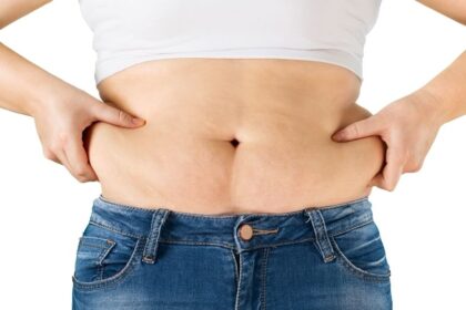 Weight Loss Surgery Journey