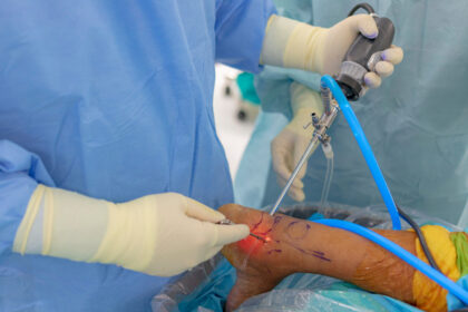 Arthroscopy in Treating Ankle Injuries