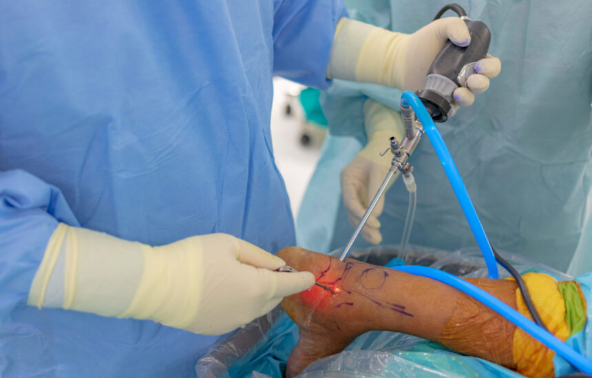 Arthroscopy in Treating Ankle Injuries