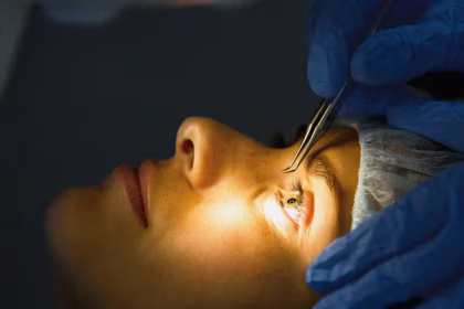 LASIK Surgery