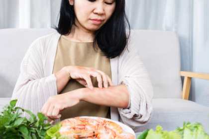 Managing Food Allergies