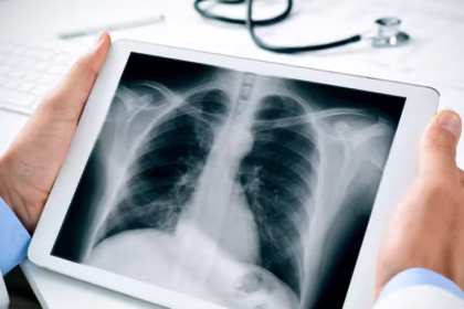 Conditions an X-Ray Can Diagnose