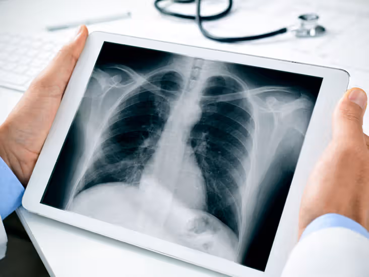 Conditions an X-Ray Can Diagnose