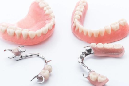Full vs. Partial Dentures